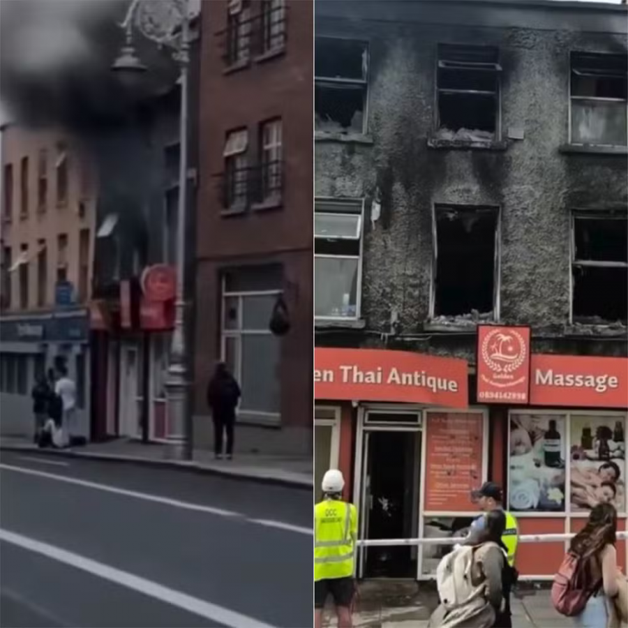 Potiguar é internado em estado grave após incêndio em prédio na Irlanda