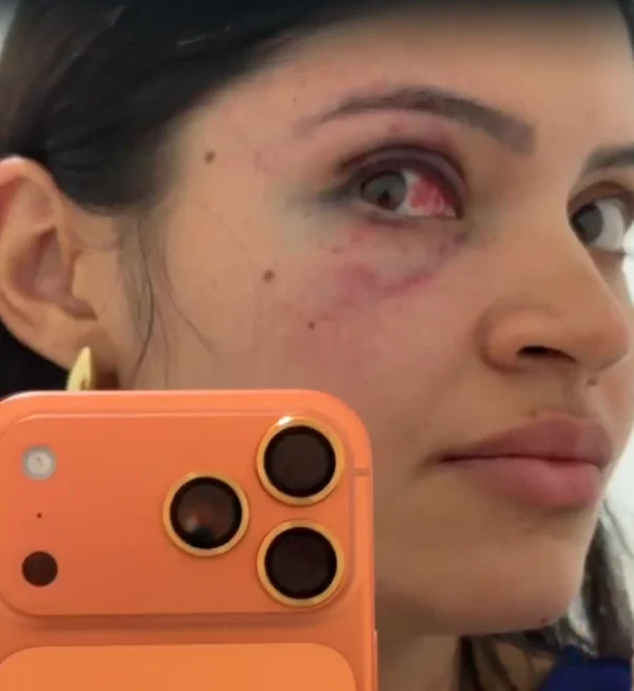 Suspeito de agredir e sufocar esposa em Parnamirim é solto após audiência